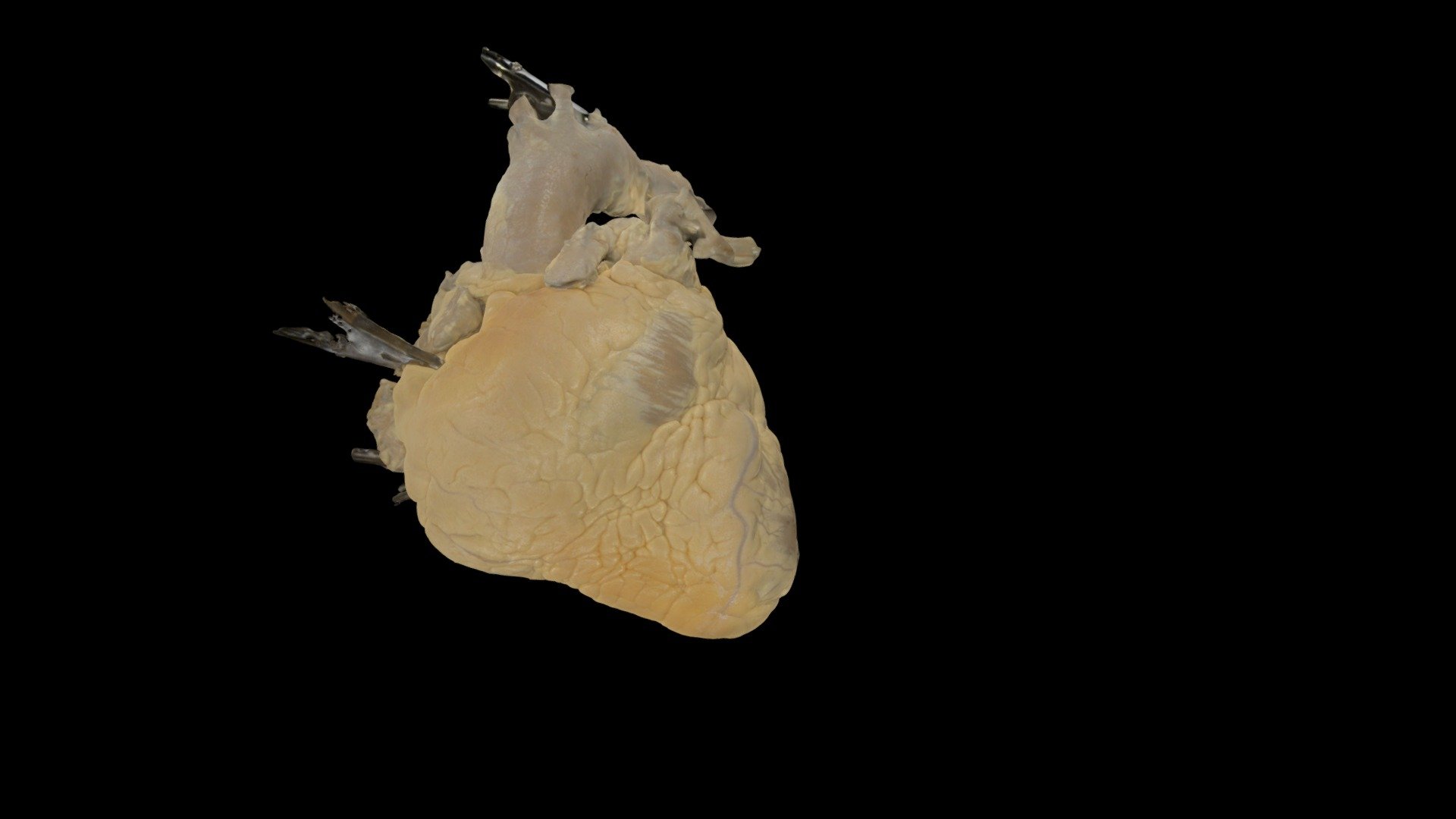 Perfusion Fixed Heart Donation #143