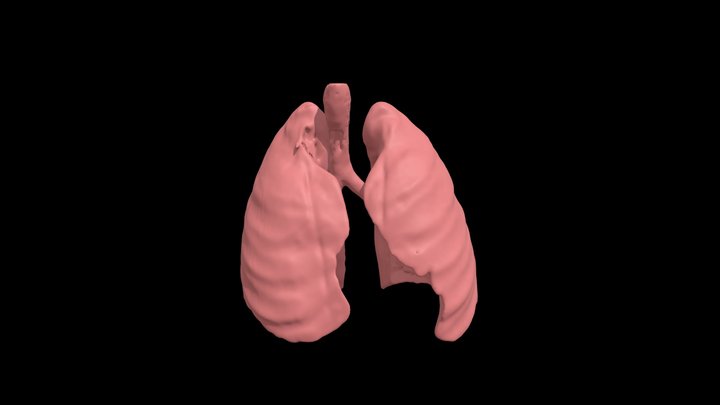 Segmentation_Lungs 3D Model