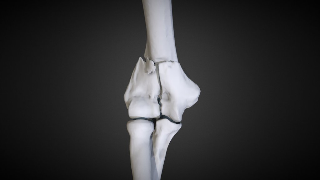 IBRA-Nov17 | #2-1 Distal Humerus (S-171502-L) - 3D model by World ...