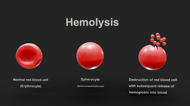 Hemolysis 3D Model