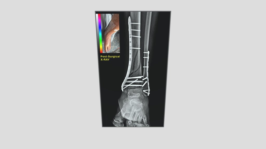 Xray_box_DMGCA