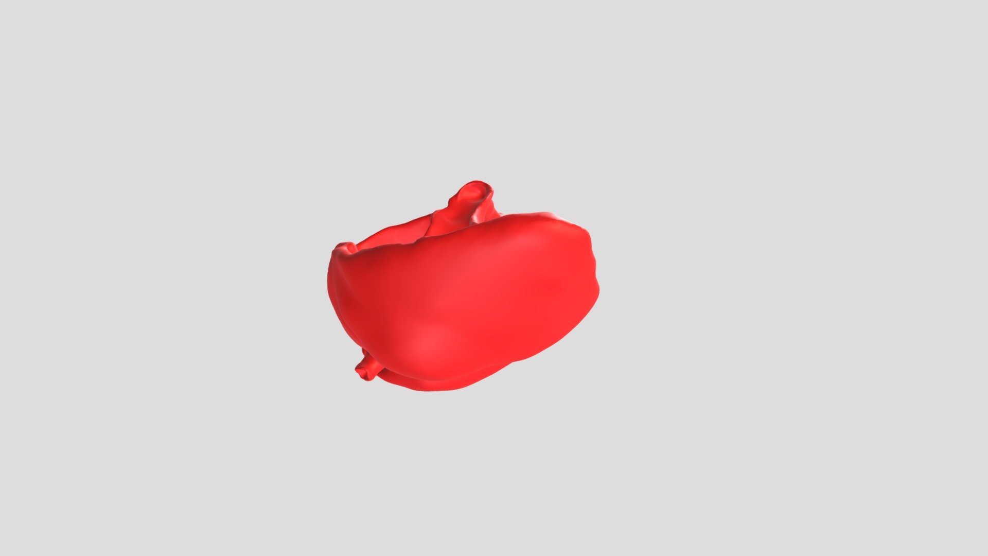 Bidirectional Glenn Operation - 3D model by bmers [b316b17] - Sketchfab