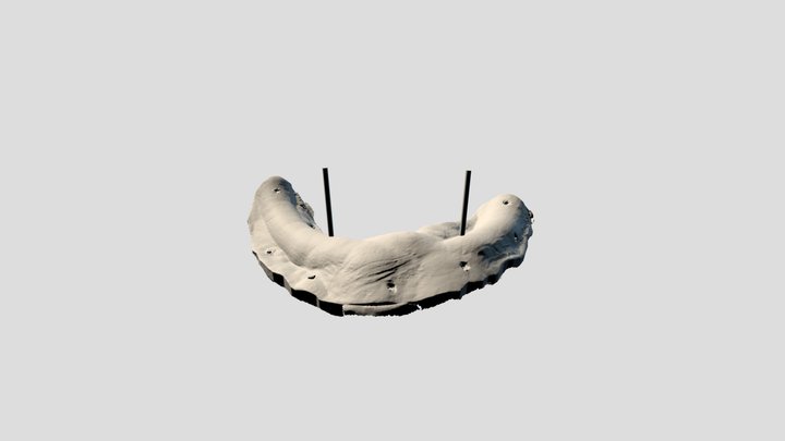 鄭O蜜 Model With Implant Axis 3D Model