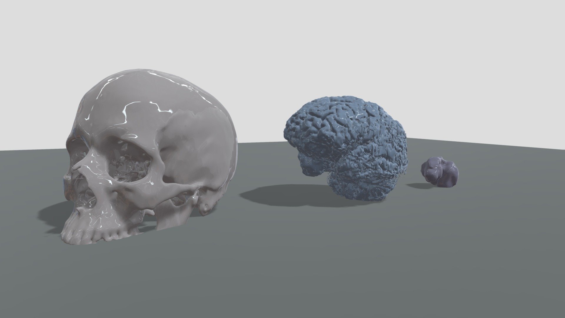 Brain Tumor and Skull