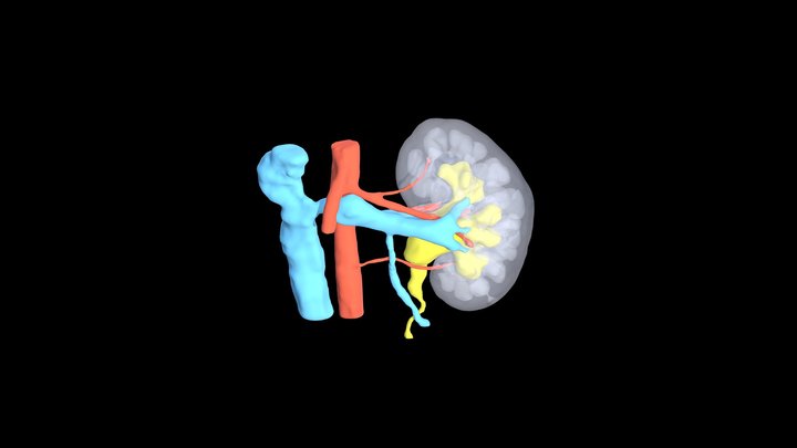Kidney Anomalous Vasculature 3D Model
