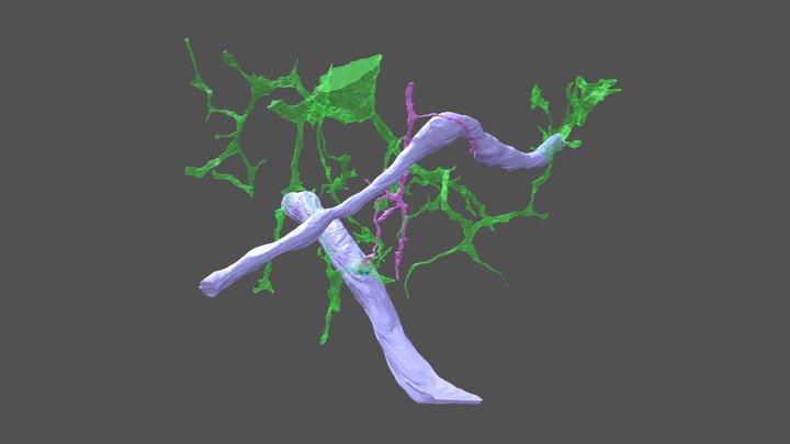 Partial phagocytosis of spine by microglia 3D Model