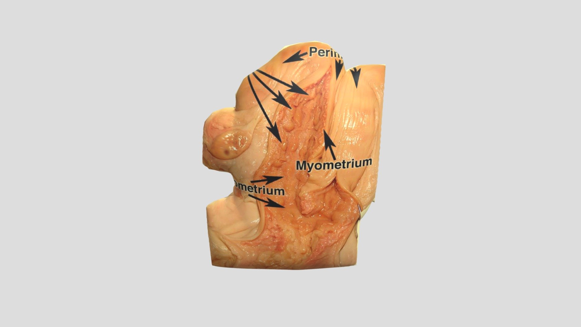 dindin Uterus