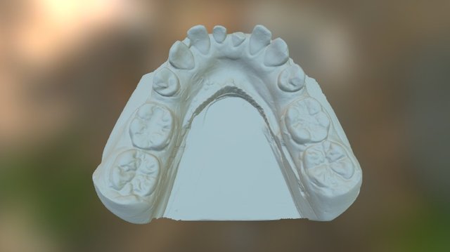 AP Lower 3D Model
