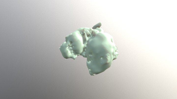 Tumor 2 3D Model