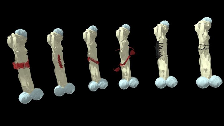 Human Bio Fractures 3D Model