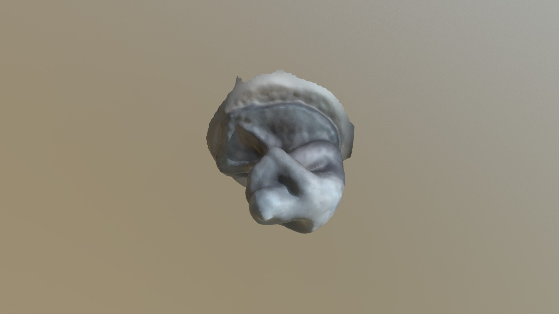 Model 1