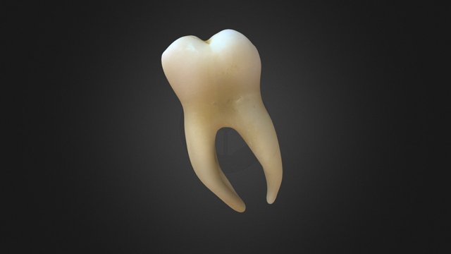 Lower 2nd Molar 3D Model