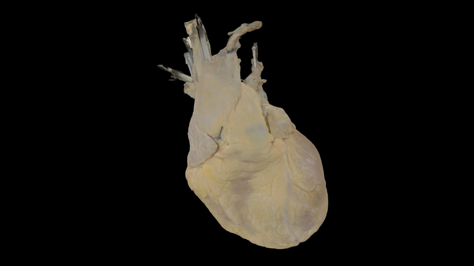 Perfusion Fixed Human Heart #486