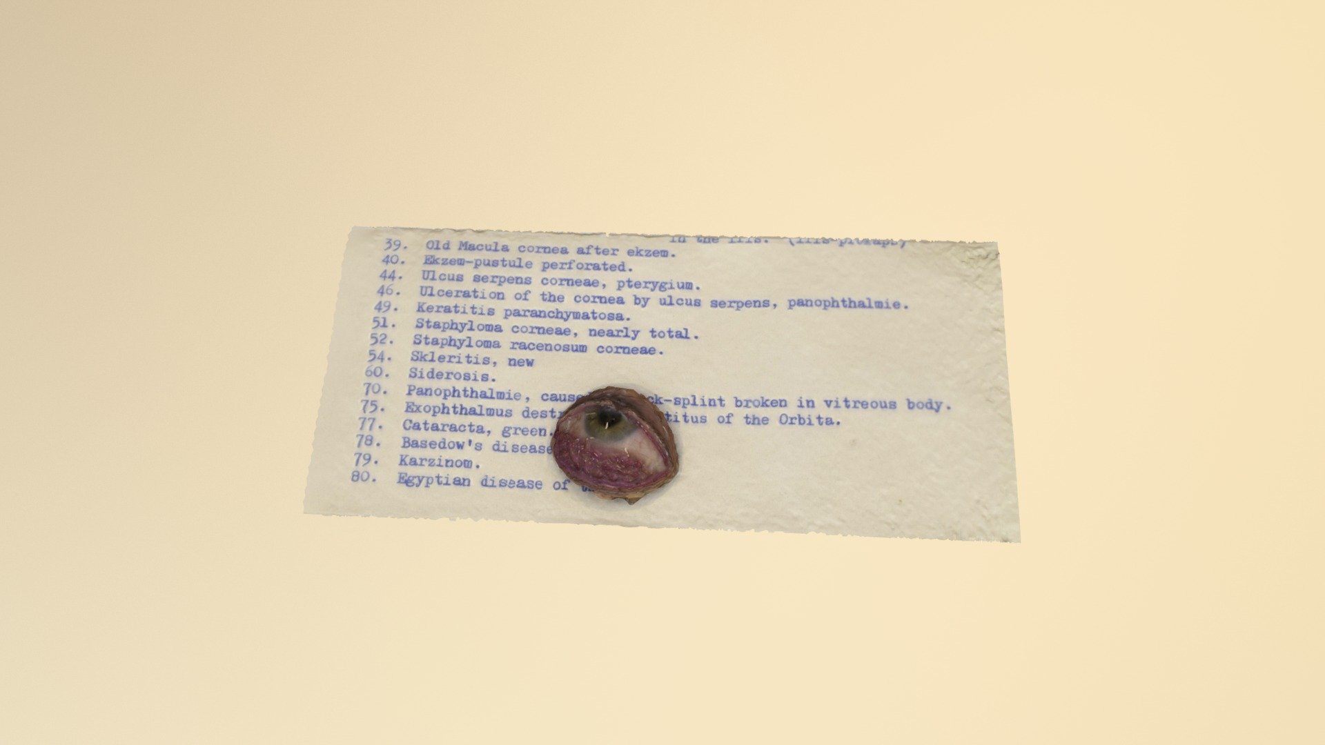 Model of a diseased eye