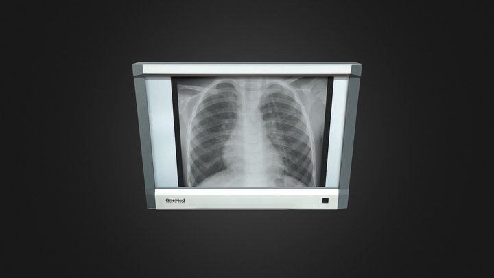 XRAY Viewer 3D Model