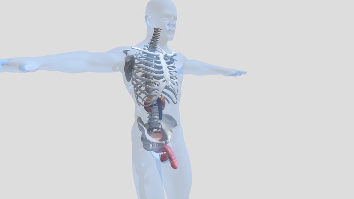 Мочеполовая система - больная модель 3D Model