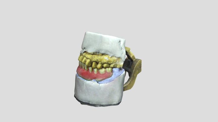 Prothesis Single Denture Try- In Scan 3D Model
