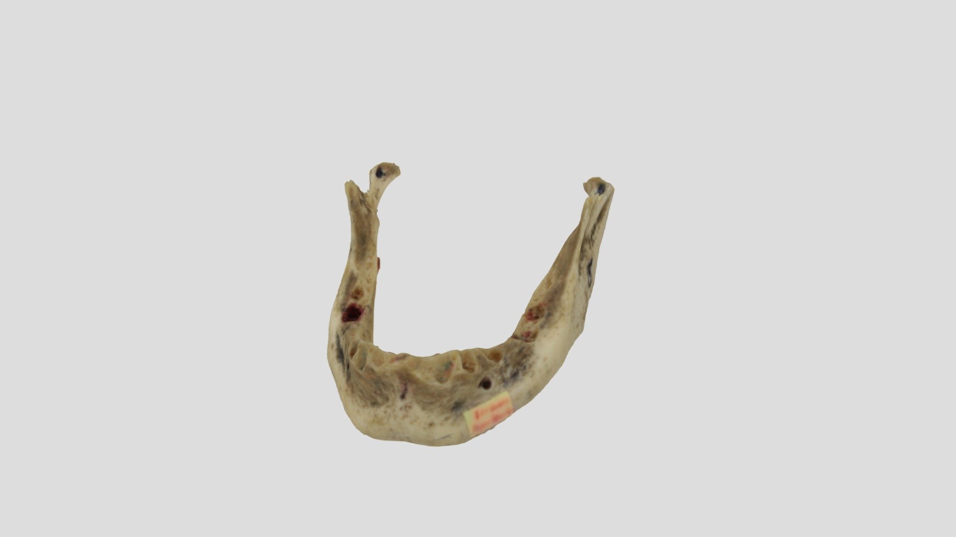 Mandibula6