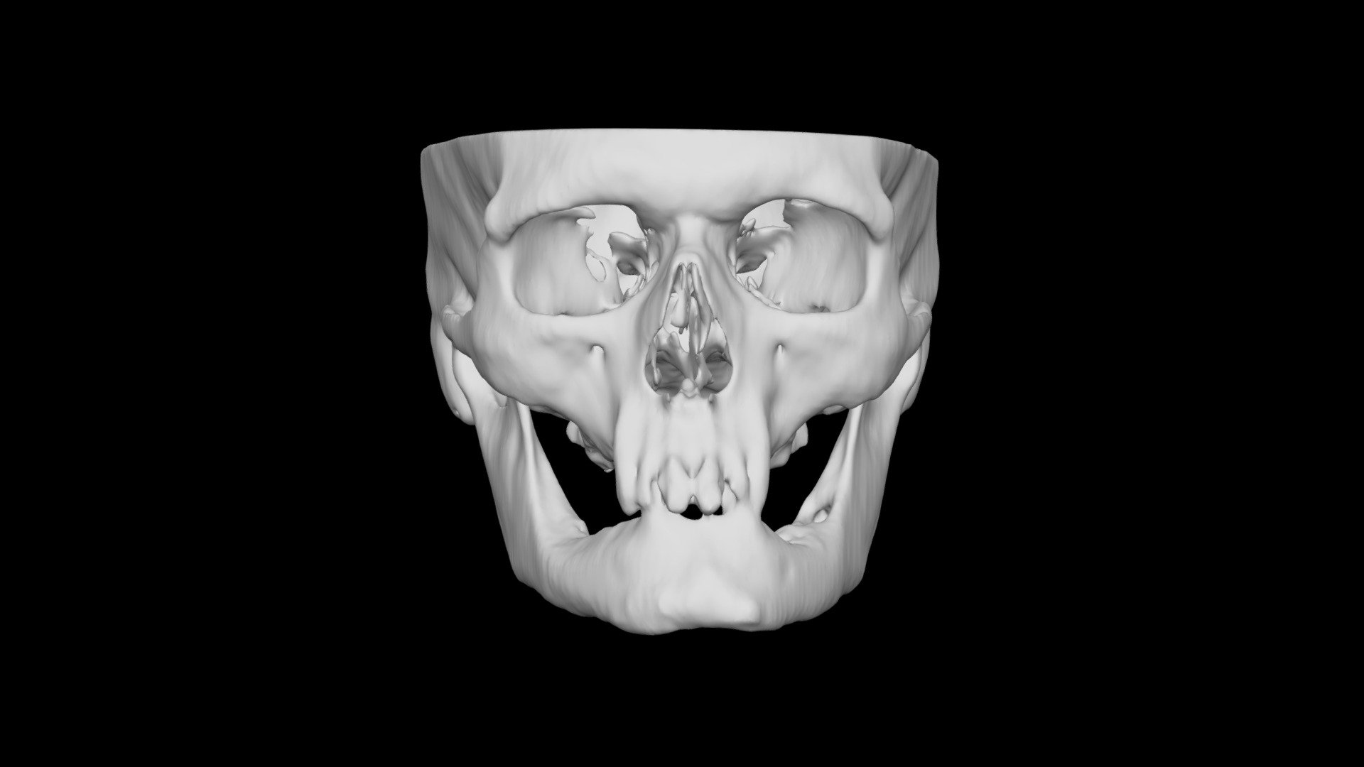 Skull Male 44yo