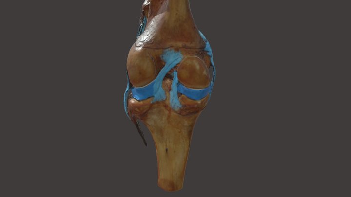 Meniscus 3D models - Sketchfab