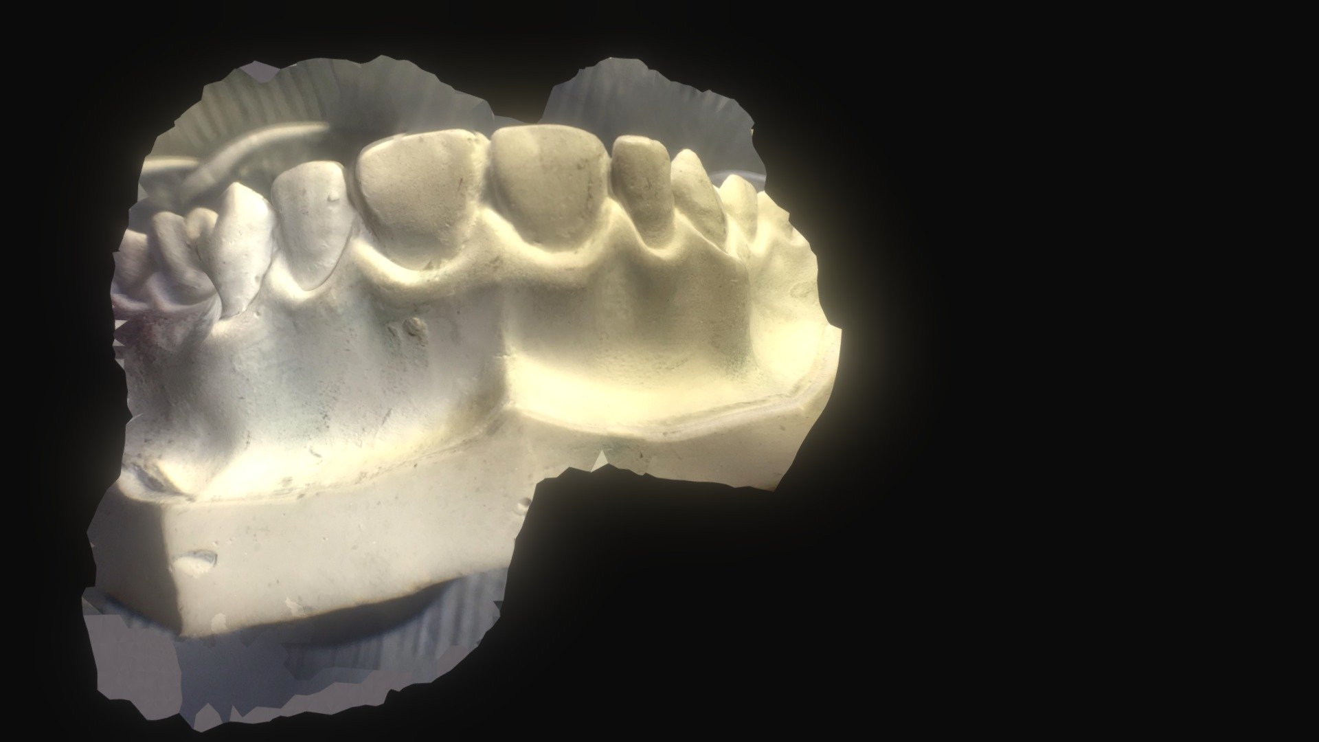 tooth