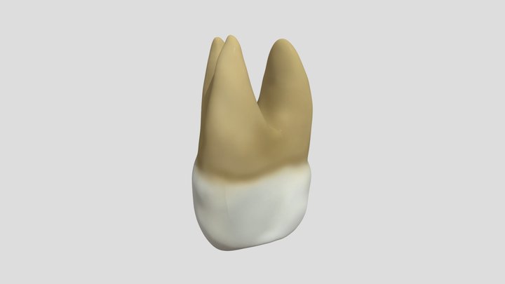Maxillary Second Molar (right)