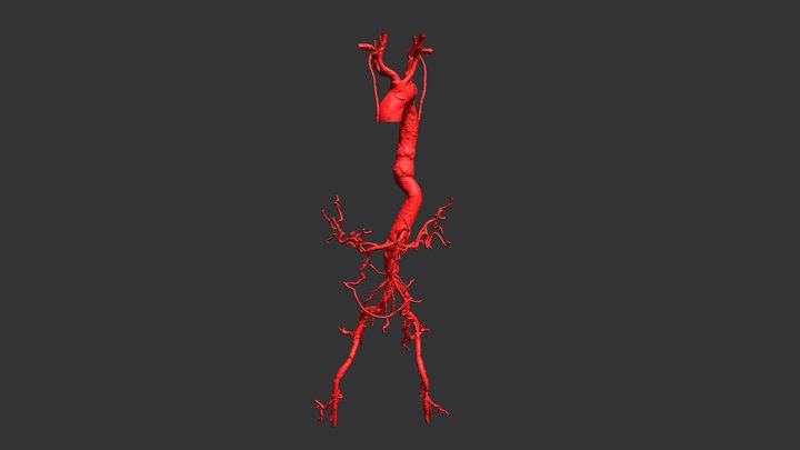 Thoracoabdominal 3D models - Sketchfab