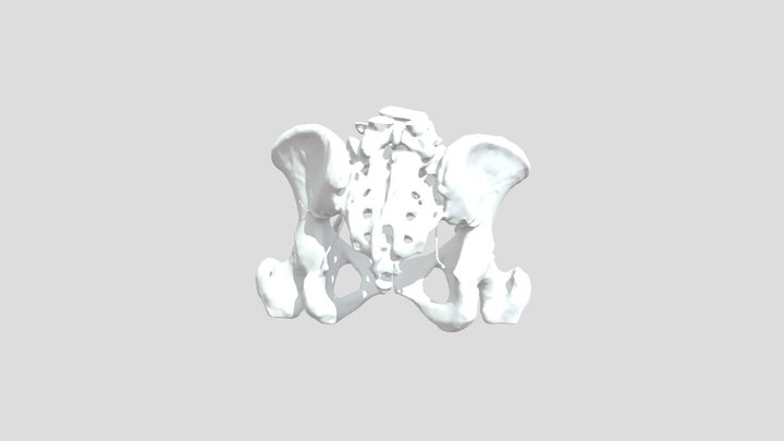 Iliac Angiography CT scan model 3D Model