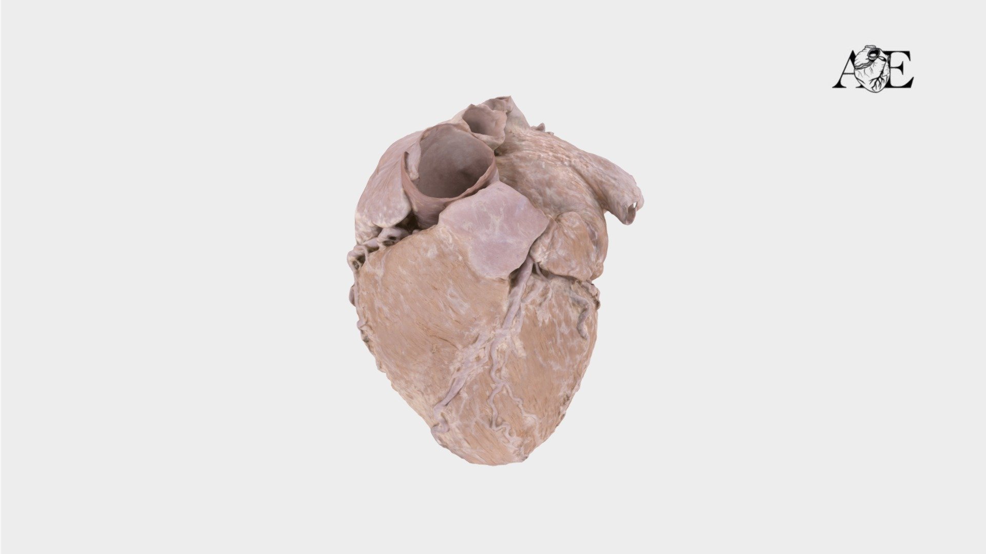 The cardiac chambers - 3D model by cardiac.anatomy.atlas [b750ed5 ...