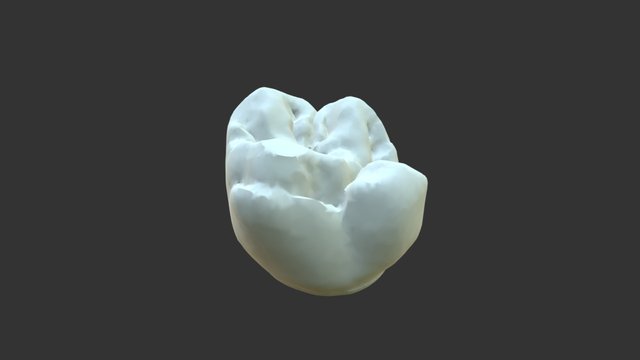Upper Molar 3D Model