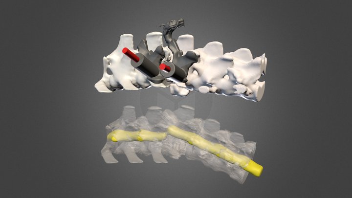 Vertebral fracture in a dog 3D Model