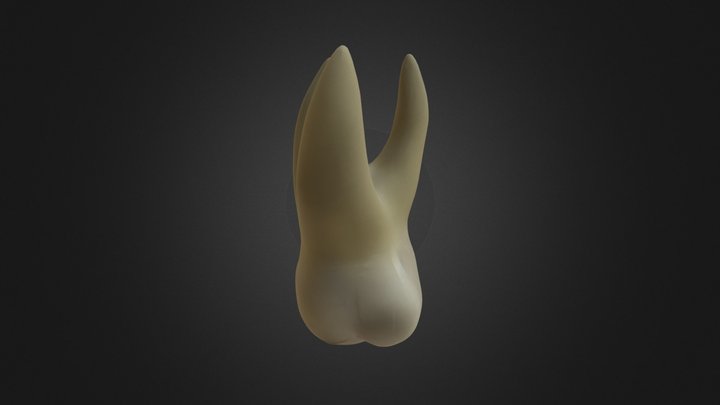 Upper 1st Molar 3D Model