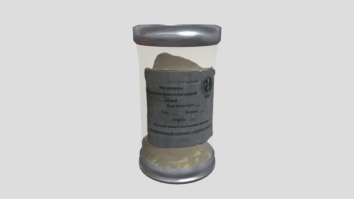 Фибринозный плеврит с отеком легких 3D Model