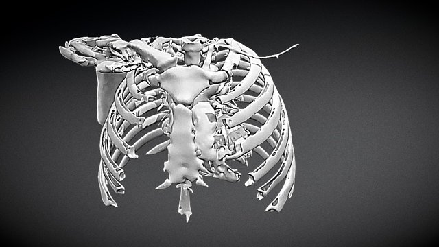 CT SCAN OF CHEST AREA 3D Model