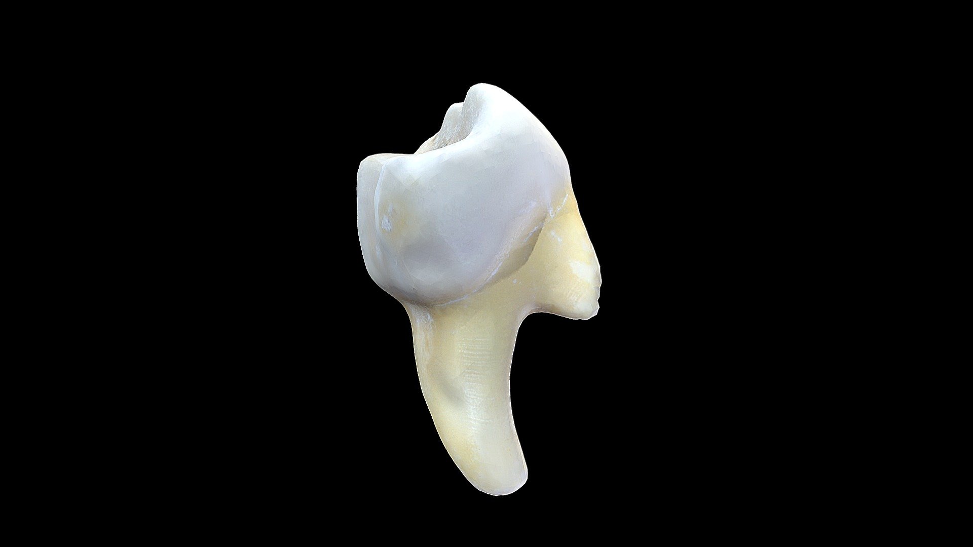 UD4 Tooth - 3D model by estherperez [b84015a] - Sketchfab