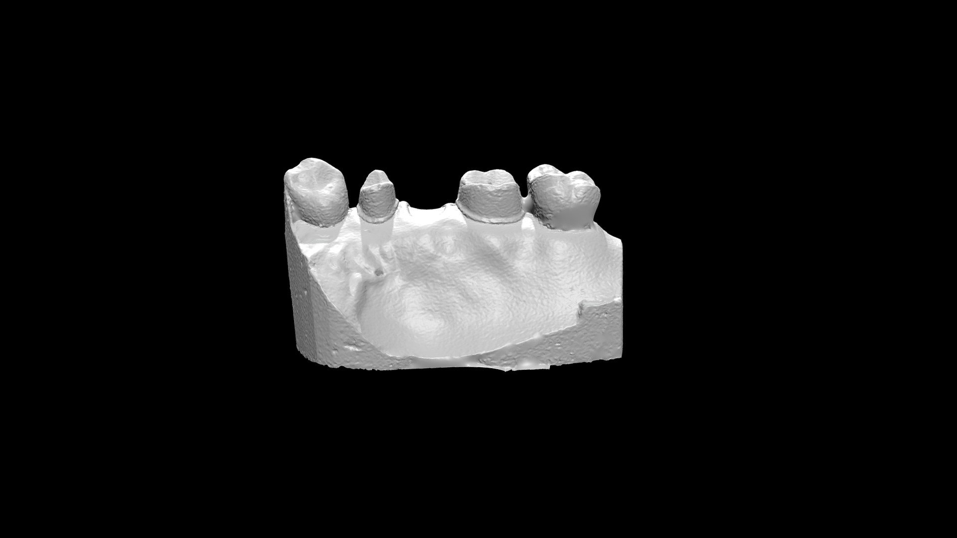 Teeth 02