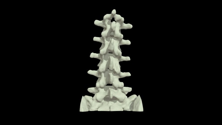 Normal Lumber Spine - Bony Anatomy 3D Model