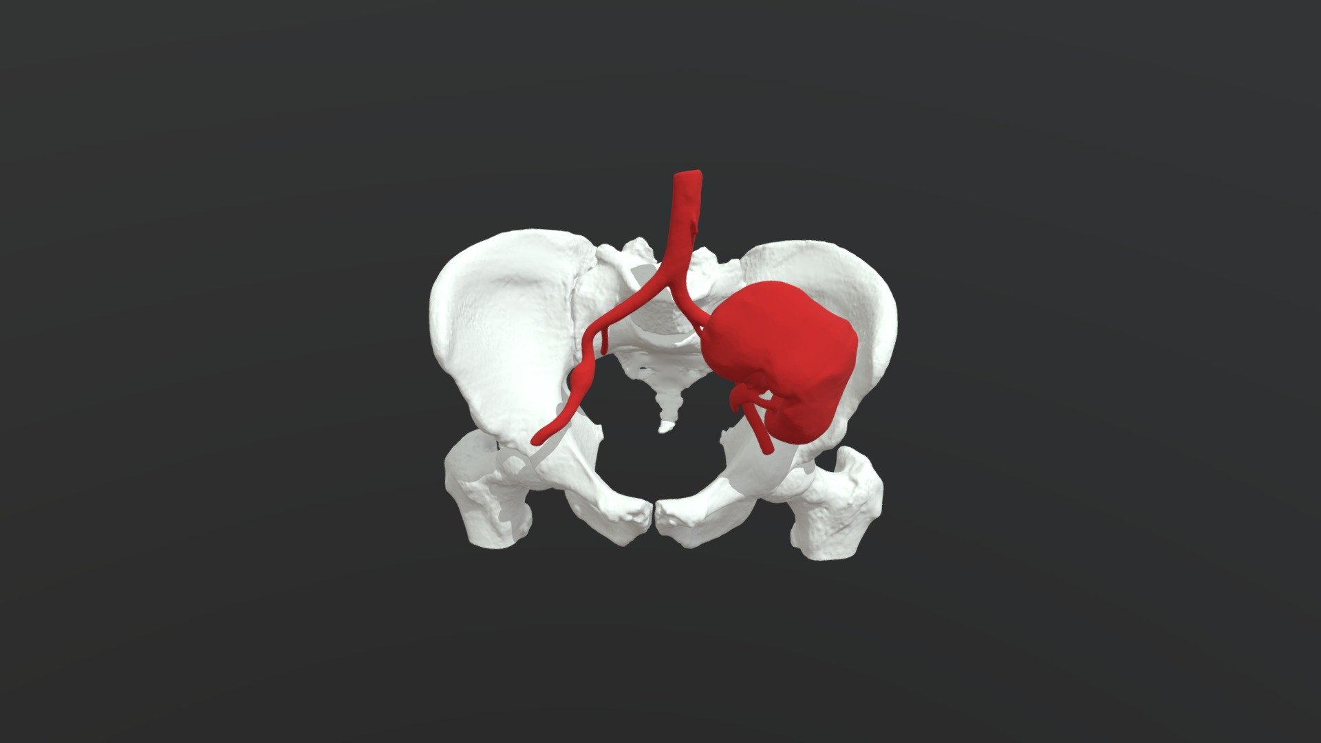 Pelvis & Renal Implant - 3D model by mihalkov3danatomy ...