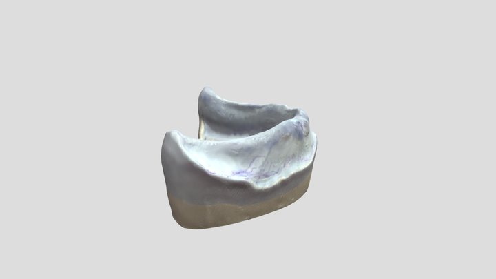 Complete Denture Lower Cast Scan 3D Model
