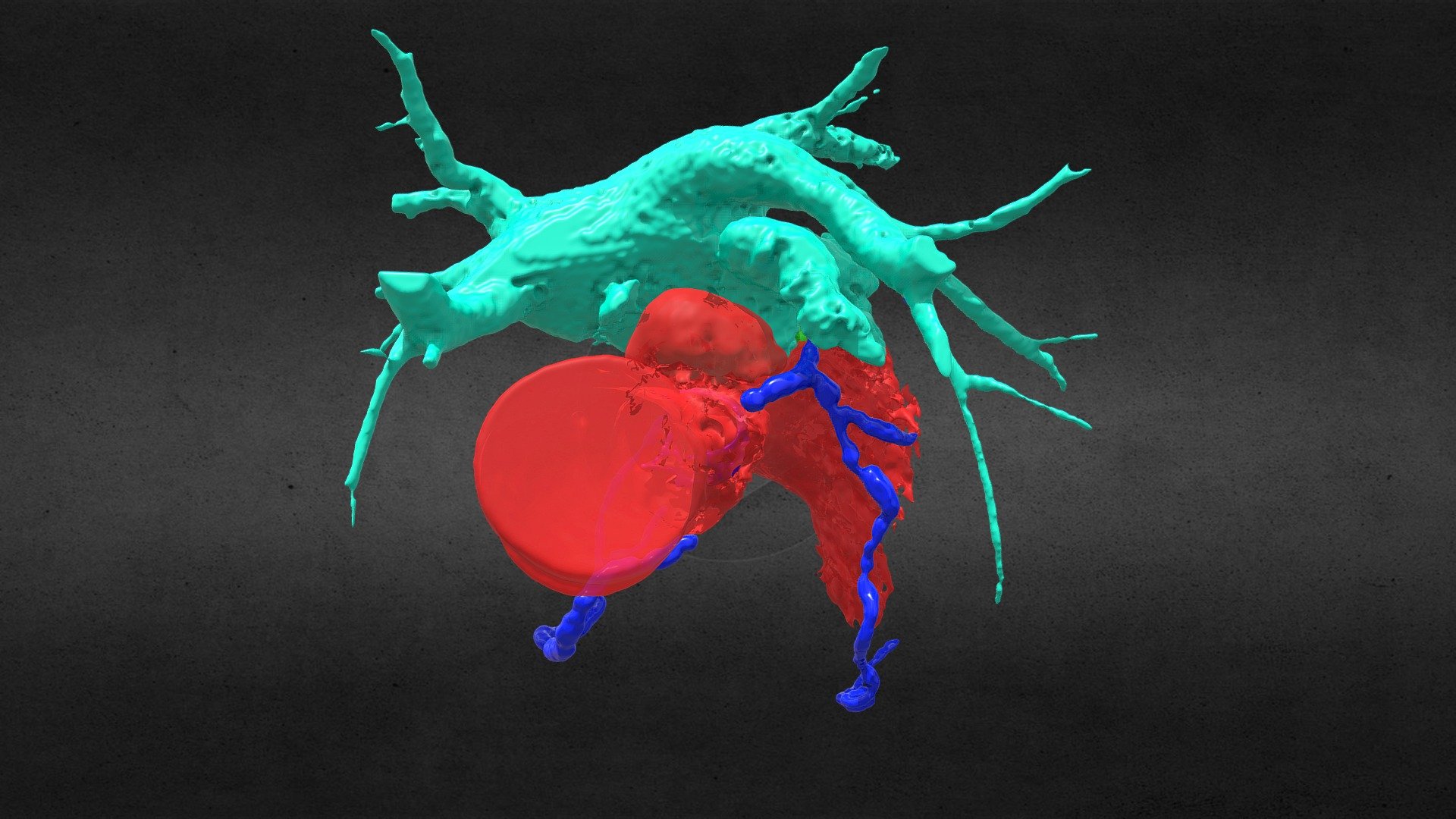 IE PseudoA - 3D model by ht3dmedica [b88152f] - Sketchfab