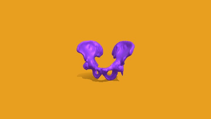 Segmentation Pelvis 3D Model
