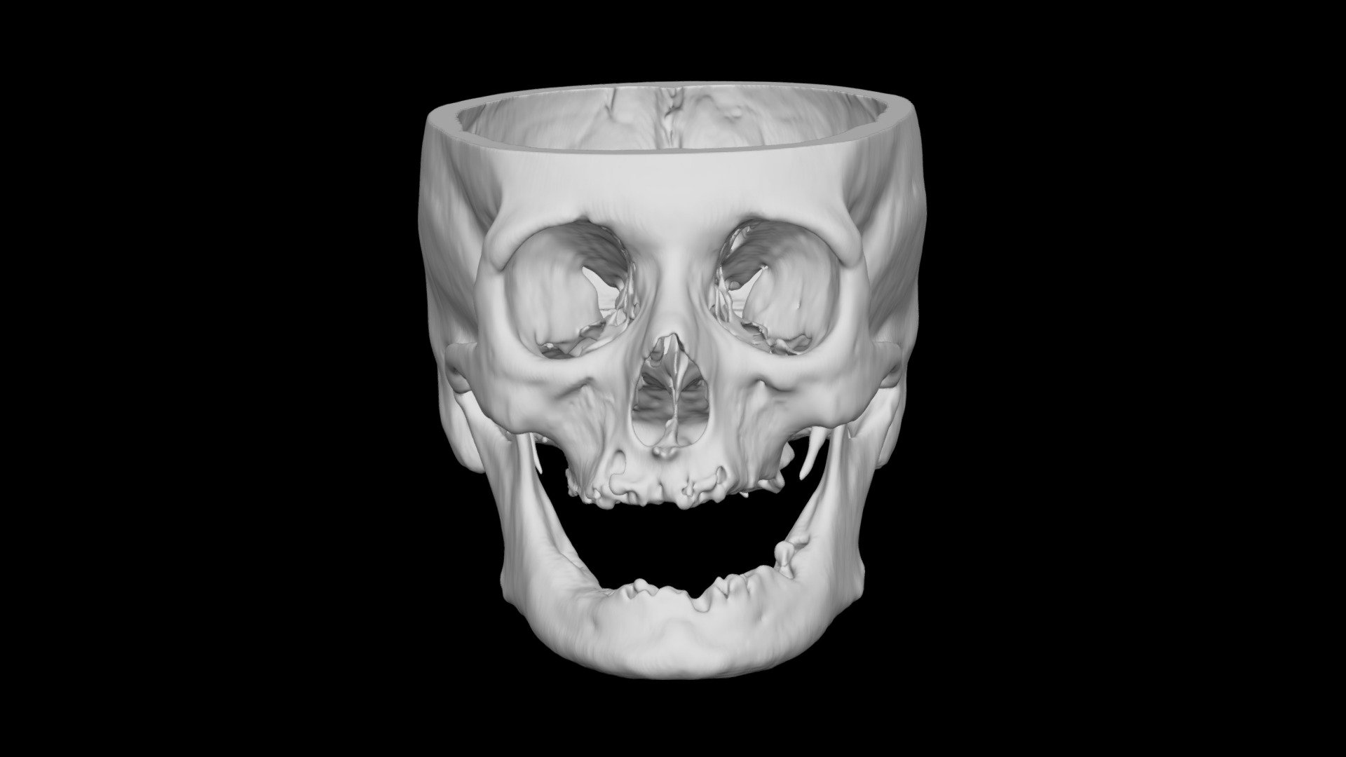 Skull Female 60yo