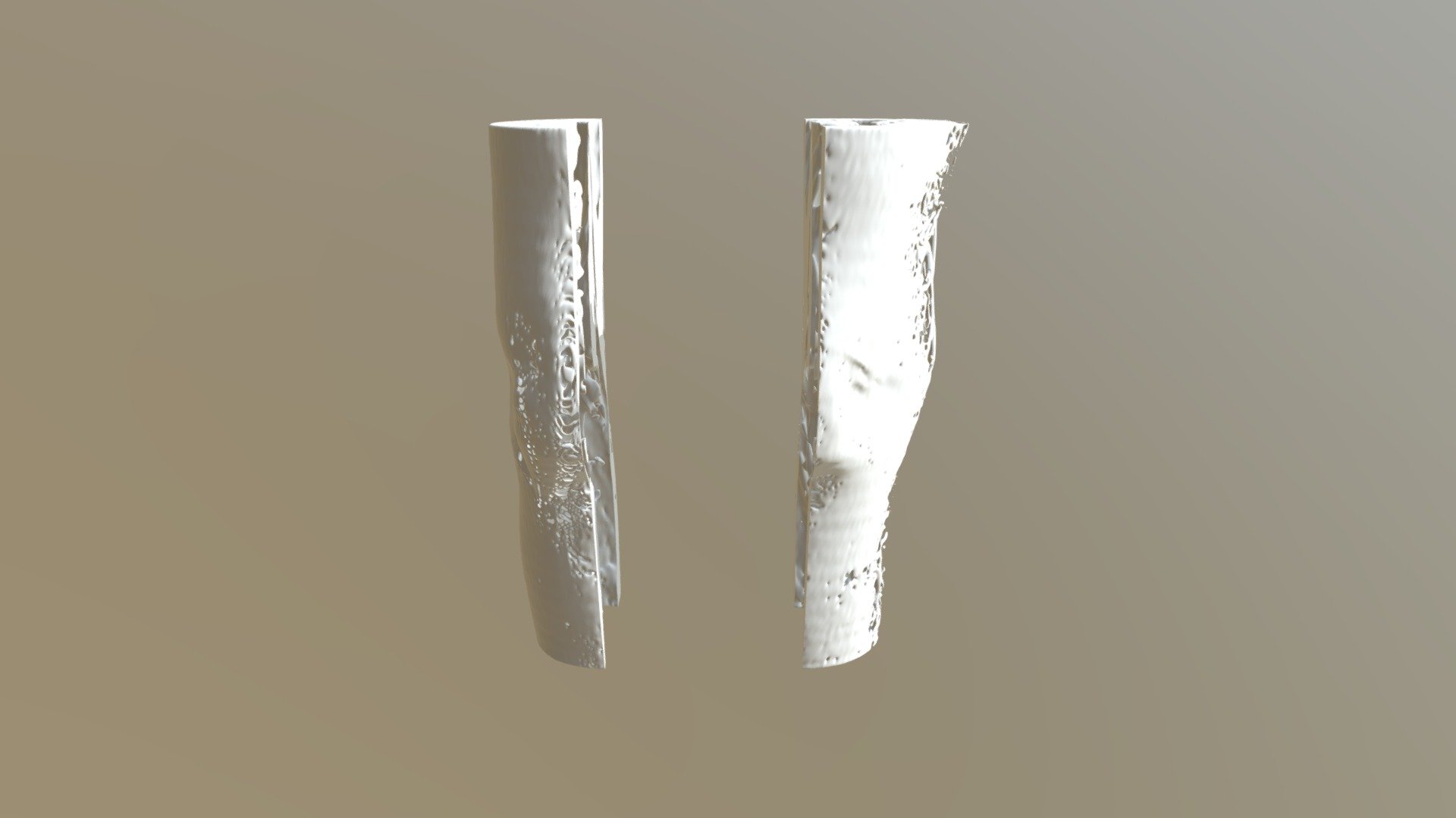 Skin Fascia rt