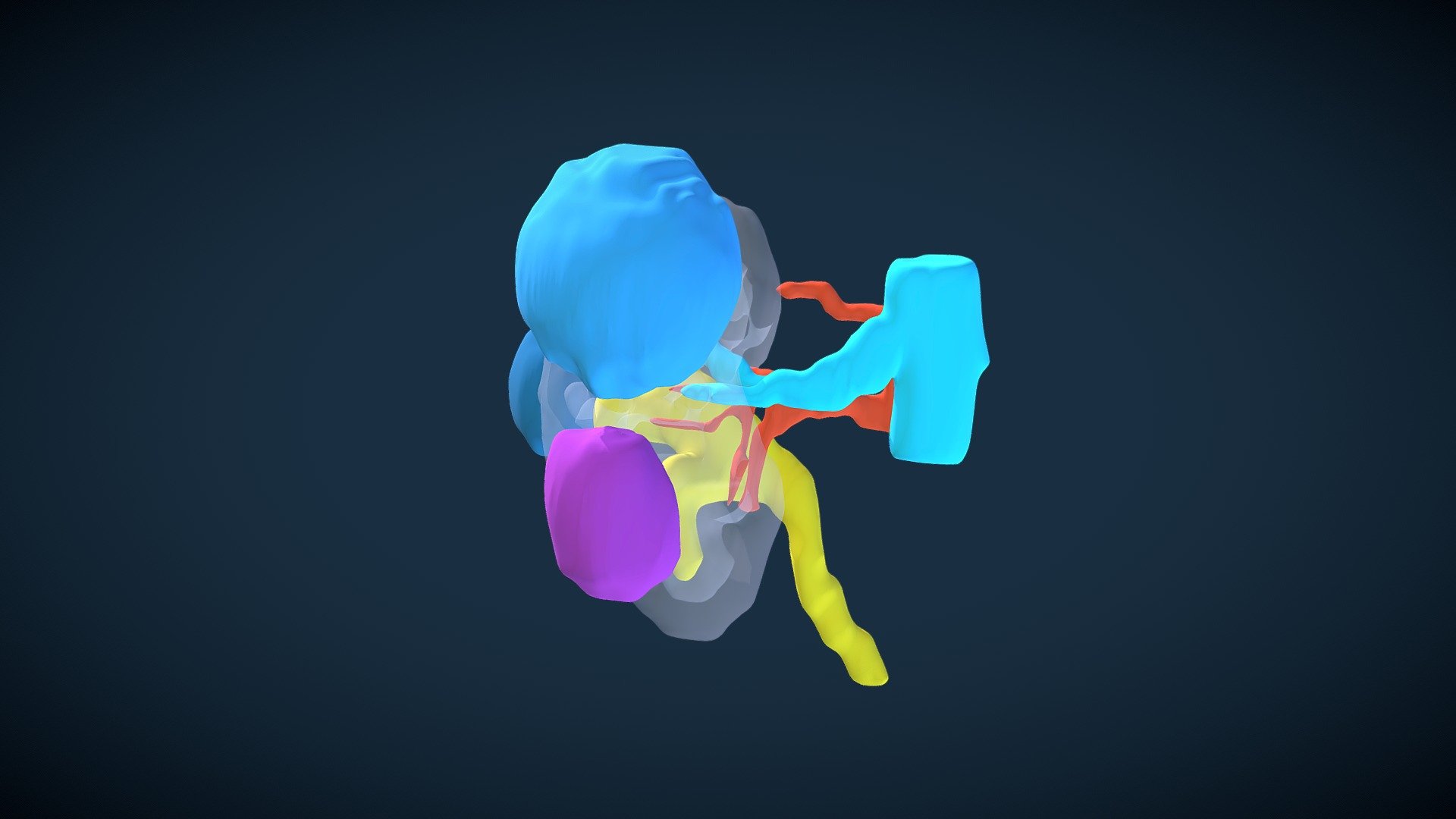 Right Kidney with Cysts (Bosniak 3) (WBF).
