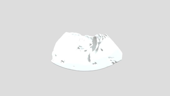 [FETAL] Twin Fetus In Utero 3D Model