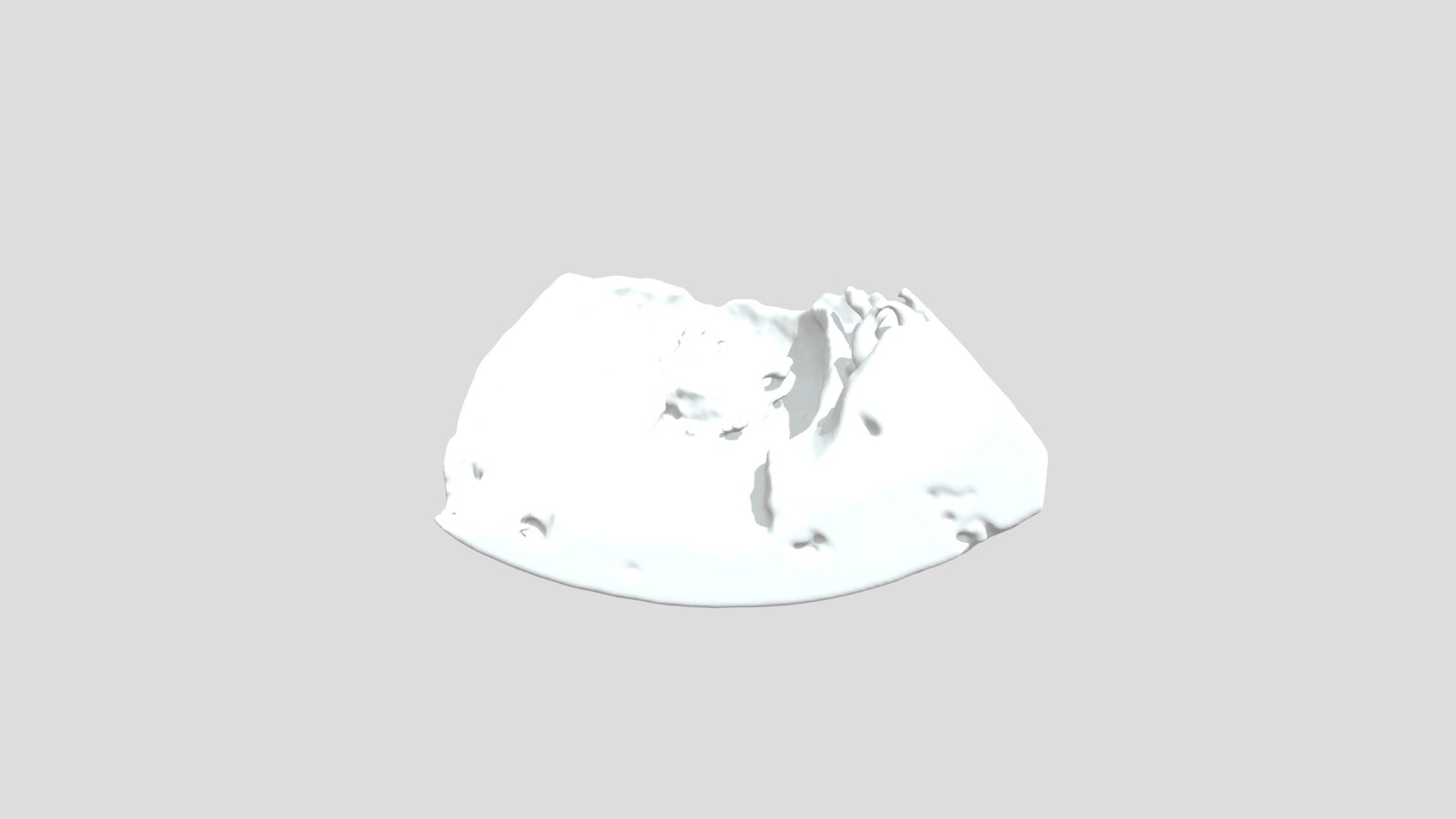 [FETAL] Twin Fetus In Utero