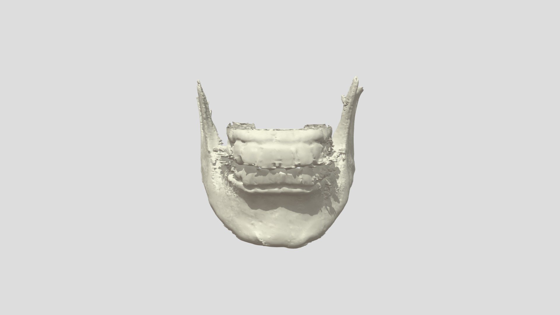 [FACE] CONTOUR SURGERY - BEFORE