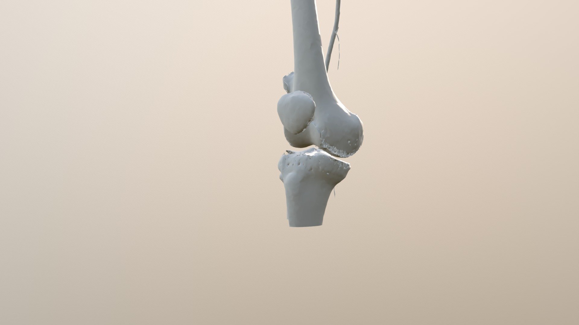 knee with mass