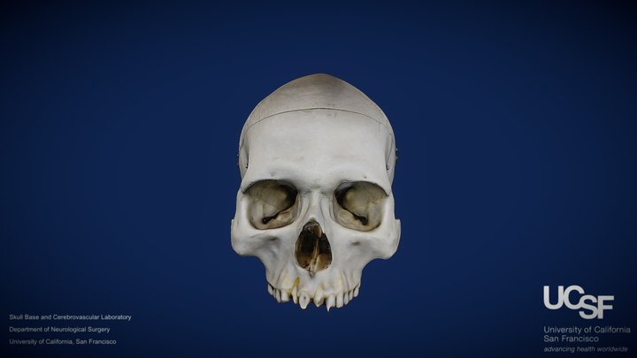 Pterional- Model 1 – Free 3D Model STL