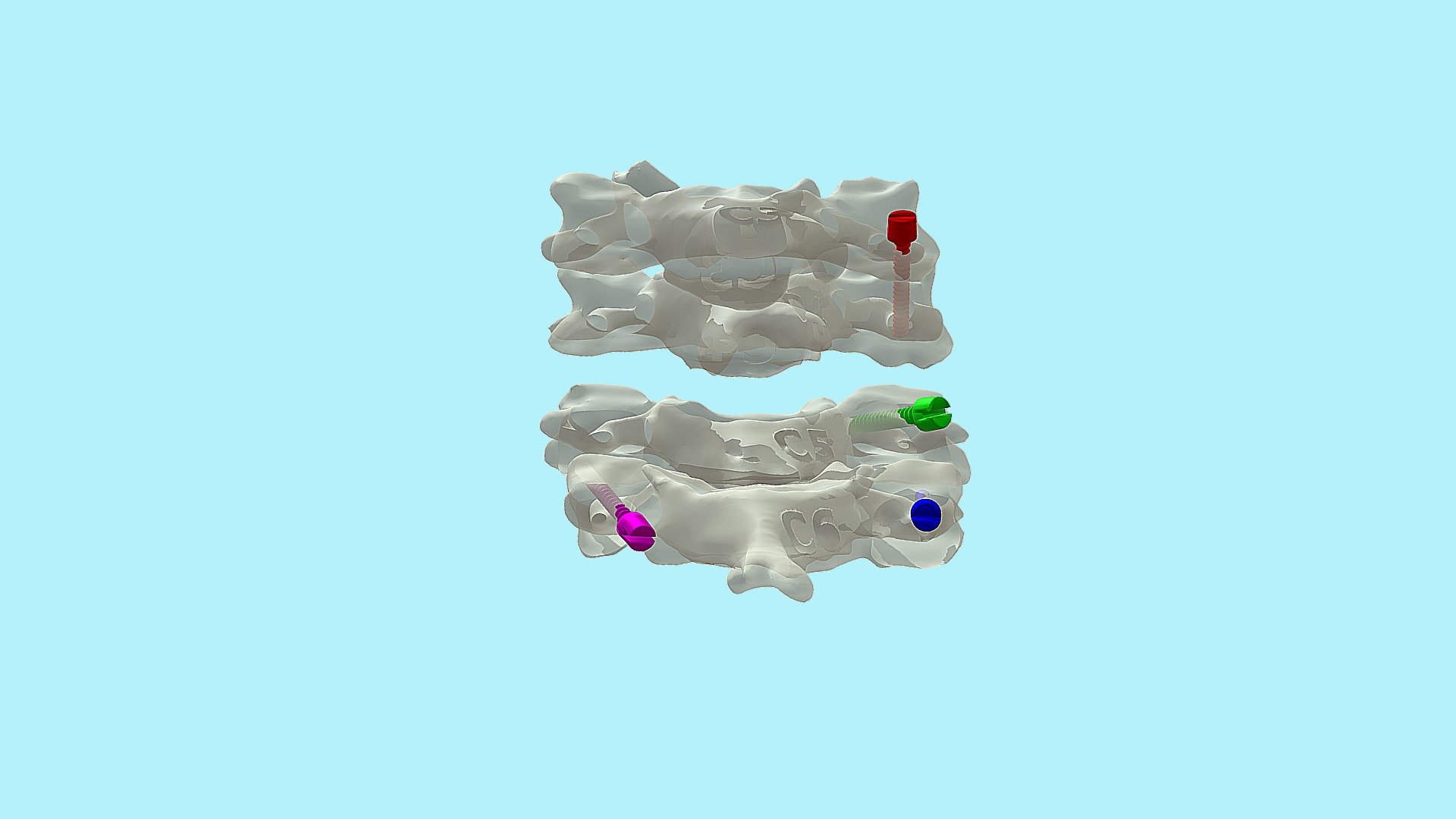 Colocación de tornillos